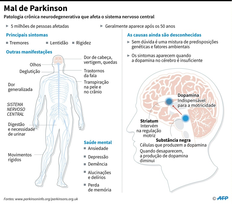 ilustração de como o mal de Parkinson se desenvolve no corpo humano