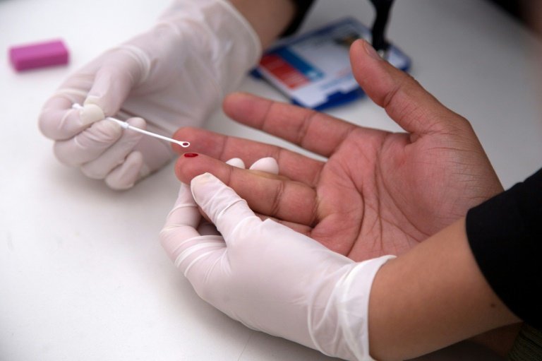 O paciente com HIV que realizou um transplante de células-tronco está agora "curado", tornando-o o segundo no mundo a se recuperar dessa doença