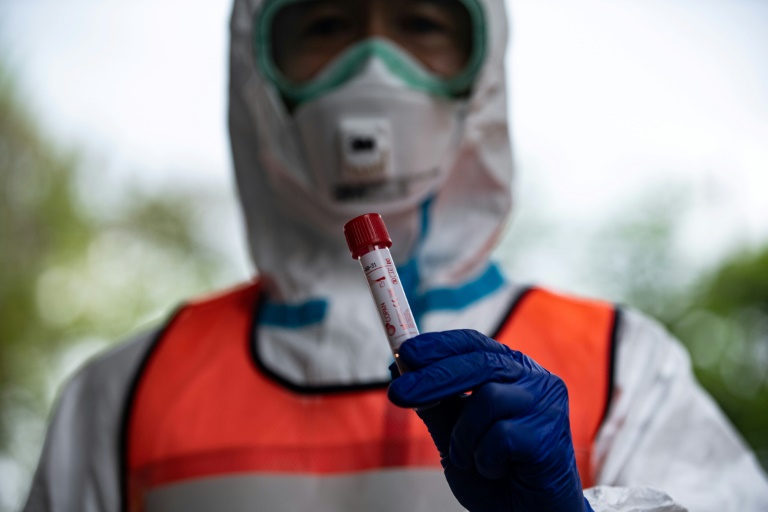 Um médico mostra um tubo usado para coletar amostras de pacientes durante uma demonstração de testes de coronavírus em Fujisawa, Japão