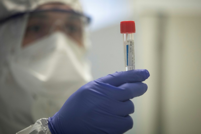 Técnico de laboratórtio com roupa especial faz teste com amostra de uma possível pessoa infectada pelo novo coronavírus