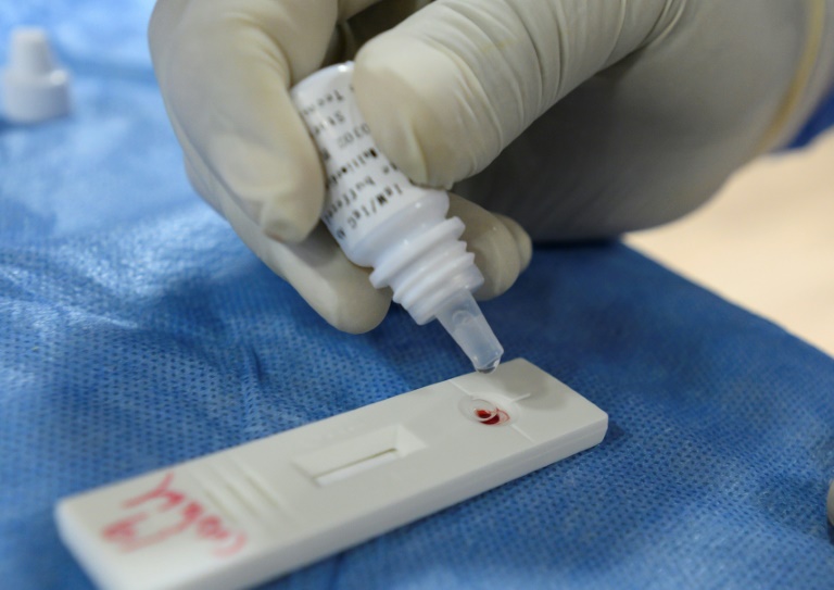Técnico de laboratório faz teste rápido para a COVID-19 em uma amostra de sangue em unidade do Ministério da Saúde peruano, em Lima, 7 de maio de 2020