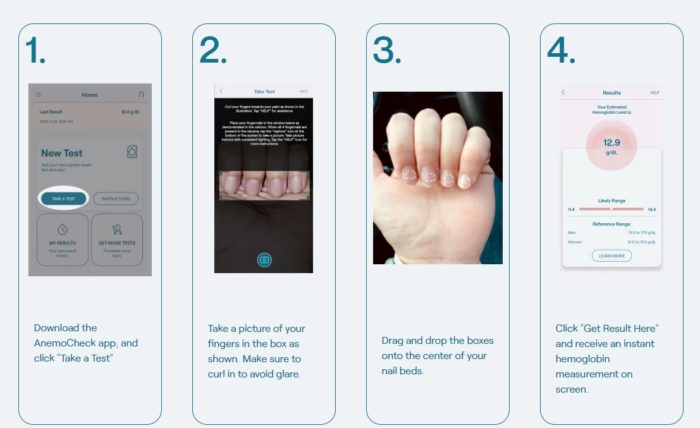 AnemoCheck promete realizar testes de anemia por meio de uma foto capturada das unhas de um usuário