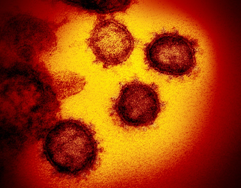 Imagem do SARS-CoV-2, o vírus responsável pela covid-19, obtida com um microscópio eletrônico