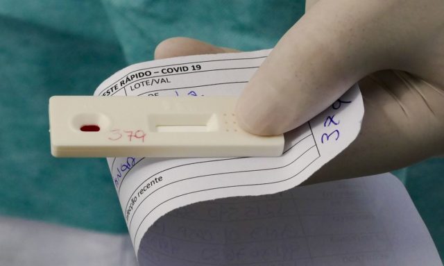 Anvisa condicionou o uso por mais 4 meses dos cerca de cerca de 7 milhões de testes RT-PCR encalhados no Ministério da Saúde a uma análise da qualidade