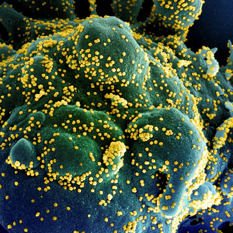 Célula humana muito infectada com partículas do vírus SARS-COV-2, isolada de uma amostra de um paciente, capturada na Instalação de Pesquisa Integrada (IRF) do NIAID, em Fort Detrick, Maryland - National Institute of Allergy and Infectious Diseases