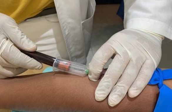 Vacina da CanSino se mostrou com alto índice de eficácia, tendo em vista que foi administrada apenas com uma dose nos vários voluntários