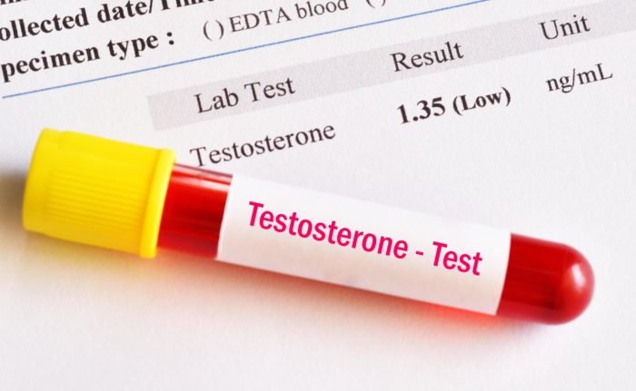 A pesquisa descobriu que quanto mais baixos os níveis de testosterona, maior a probabilidade de os pacientes necessitarem de cuidados intensivos