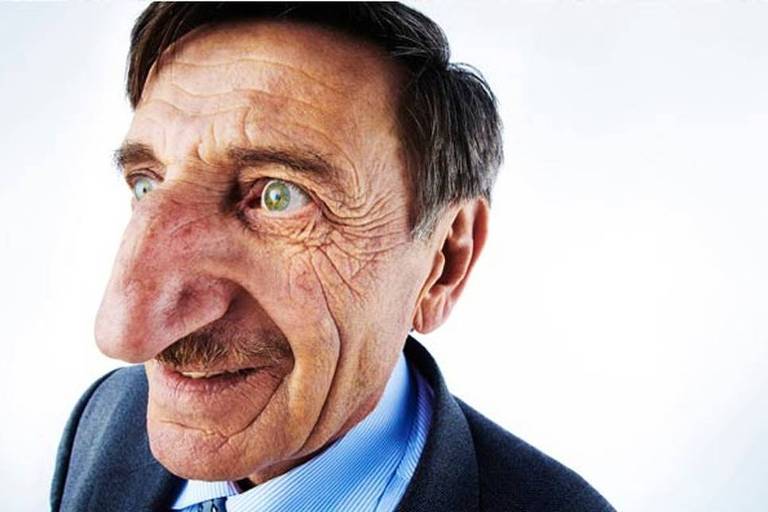 Mehmet, de 72 anos, tem 8,8 centímetros de nariz, segundo a última medição do Guinness World Records