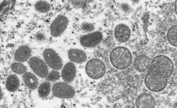 EUA intensificam vacinação contra varíola dos macacos