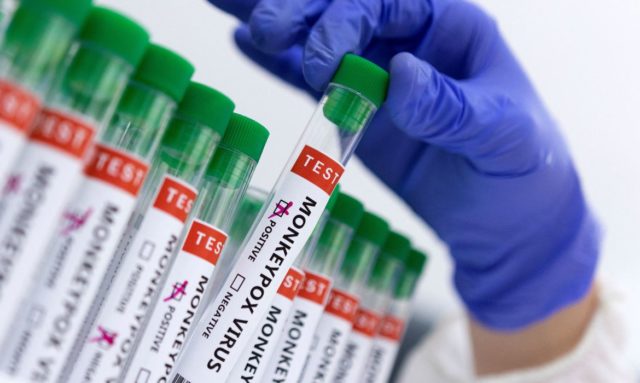 Ministério confirma mais um caso de varíola dos macacos no país