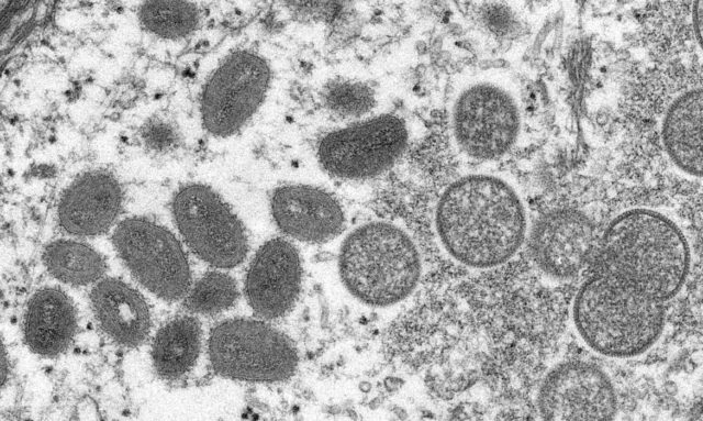 Brasil tem oito casos suspeitos de varíola dos macacos