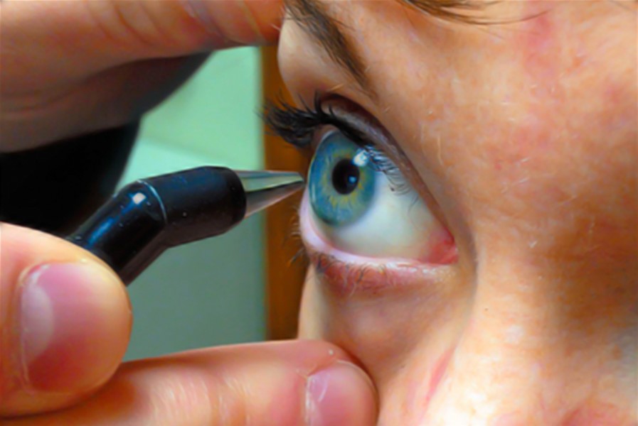 A equipe desenvolveu um implante que se assemelha à córnea humana e a técnica foi capaz de restaurar a visão a 20 pessoas com córneas doentes