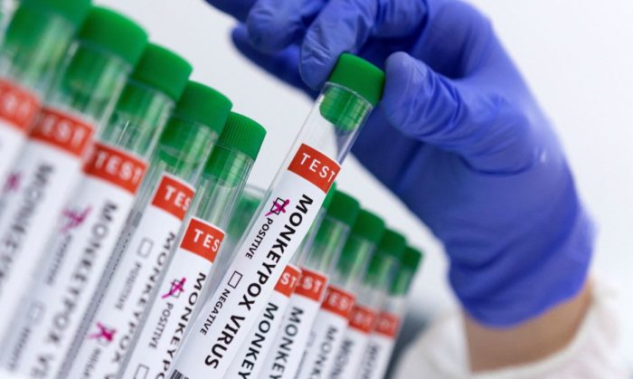 Pesquisa indica risco de monkeypox agravar infeccão por HIV
