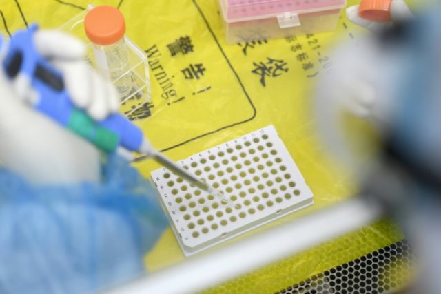 Diretor do FBI diz que pandemia de covid "provavelmente" foi provocada por acidente em laboratório de Wuhan